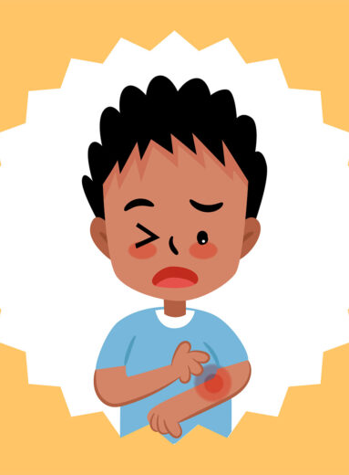 Img-Post-Anafilaxia-na-Escola-21-06-21